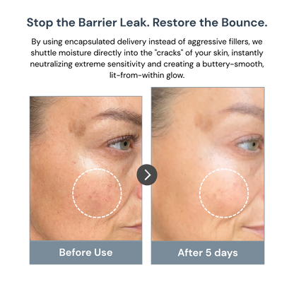 RADIAIRE Lipid-Lock™ Capsule Cream